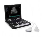 Full Digital Laptop Ultrasound Scanner